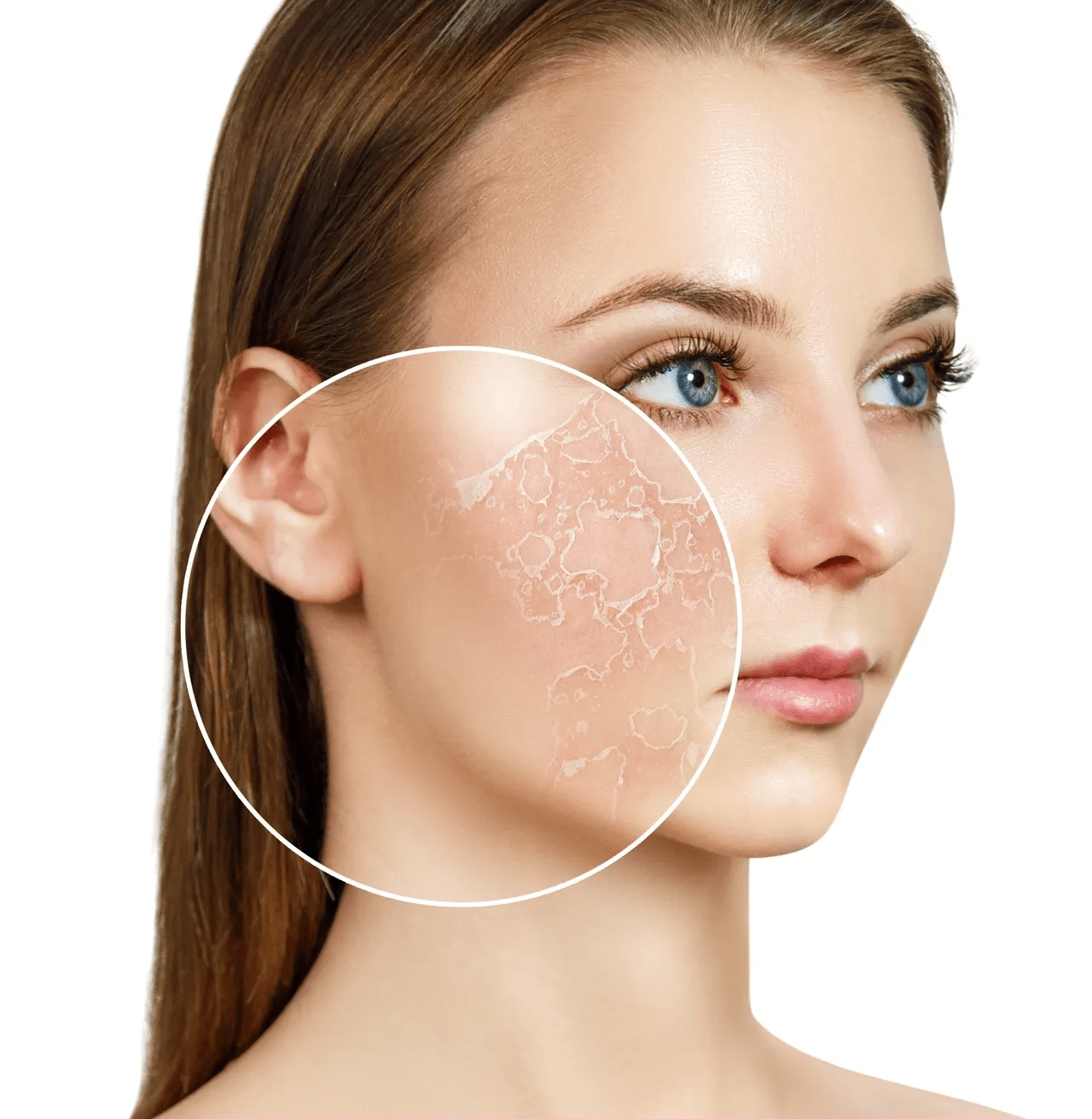 Best Skincare Routine for Dry, Flaky Skin During Winter - Glopetra