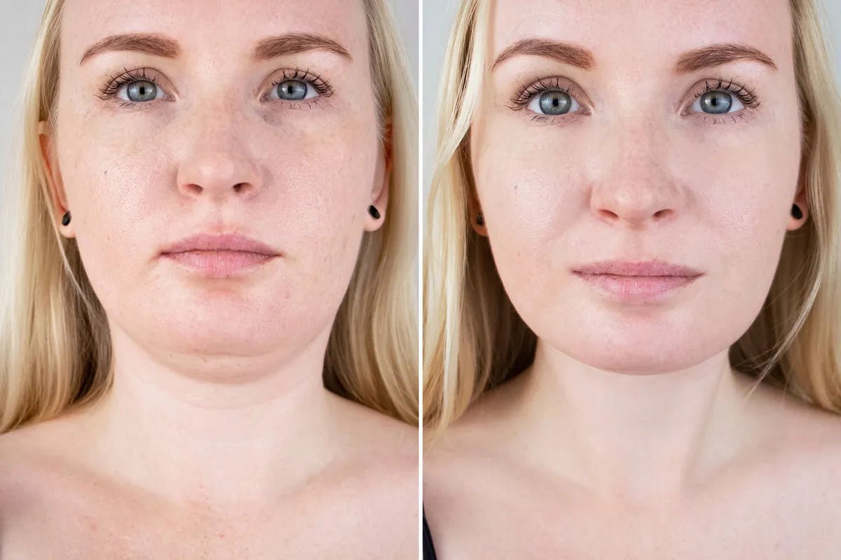 How Long Does It Take for Retinol to Show Results? - Glopetra