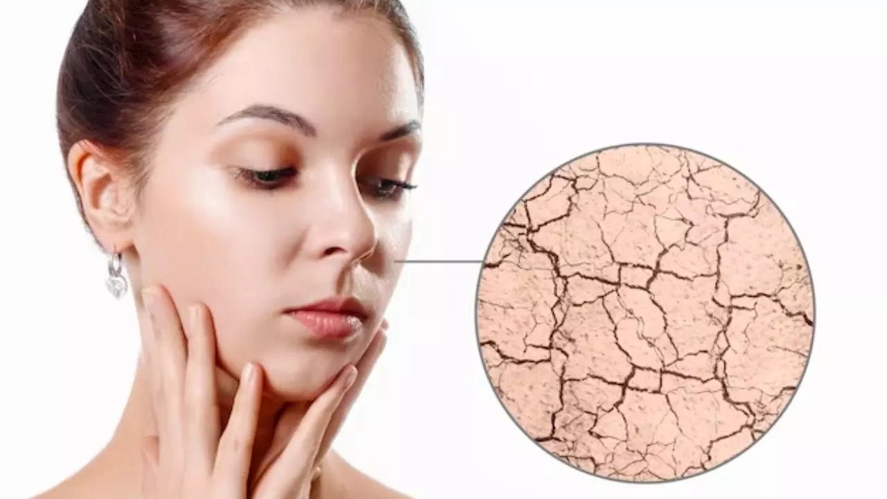 How to Prevent Dryness While Using Retinol in Winter - Glopetra
