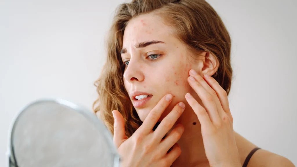 How to Protect Your Skin from Urban Pollution with Antioxidants - Glopetra