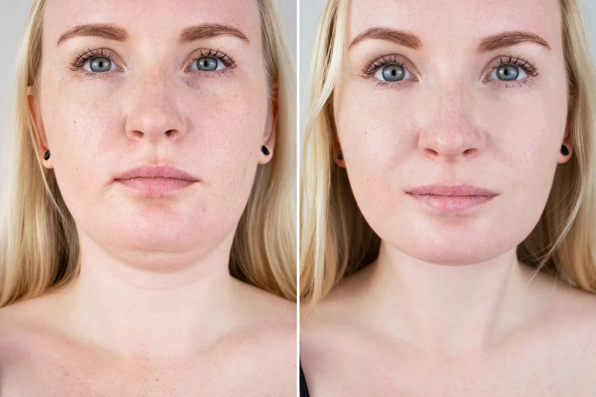 How Long It Take for Retinol to Show Results?