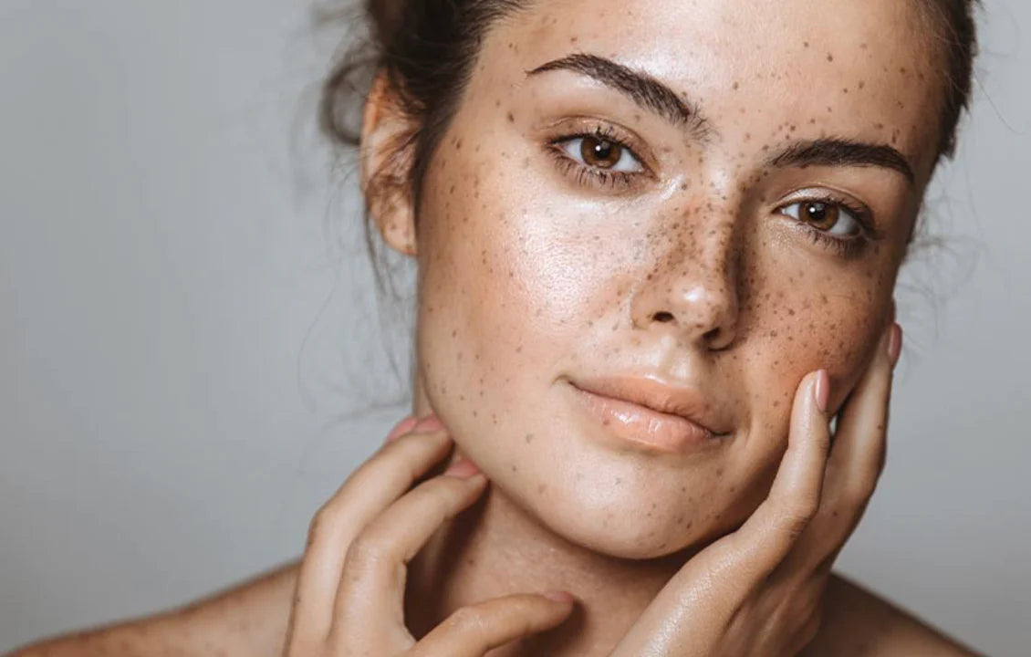 Top 10 Vitamin C Serum Brands for Hyperpigmentation