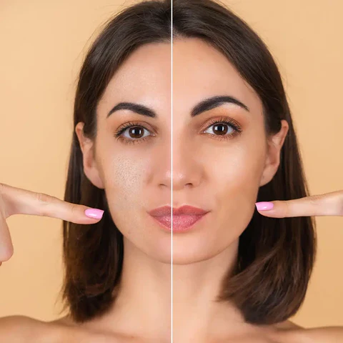 How to Treat and Prevent Fine Lines with Niacinamide