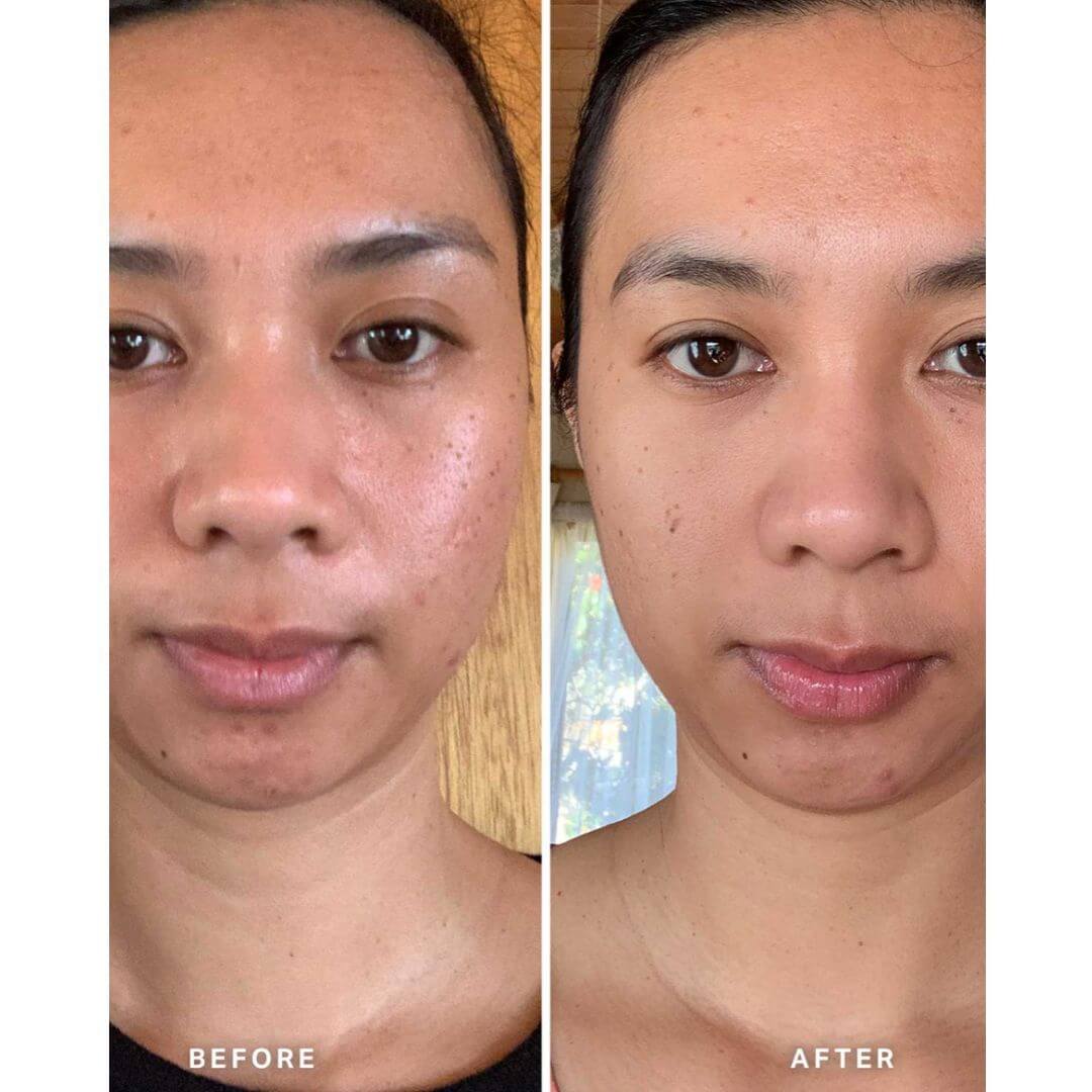 How to Fade Dark Spots with Vitamin C Serum - Glopetra