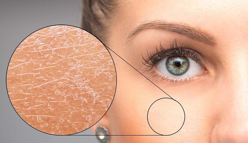 The Role of Ceramides in Strengthening Your Skin Barrier - Glopetra