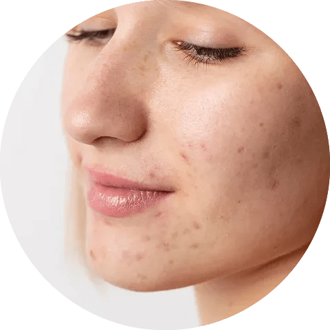 Best Cream for Dark Spots on Face - Glopetra