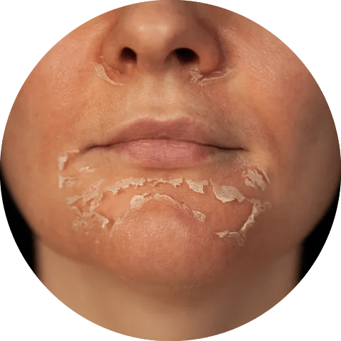 Sunscreen for Dry Skin - Glopetra