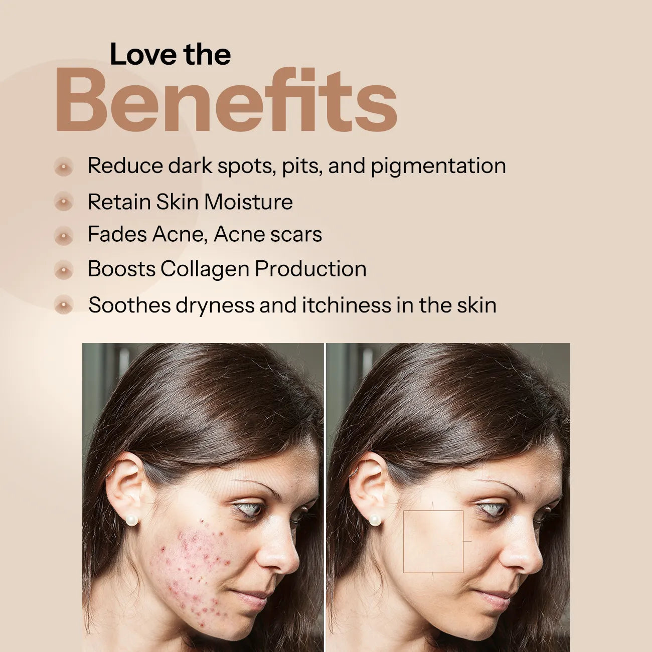 Glopetra Anti-Acne, Wrinkles Free Face Wash with Acne Scars & Pits Removal Gel