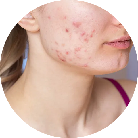 Glopetra Skin & Hair Care | Chemical-Free Products
