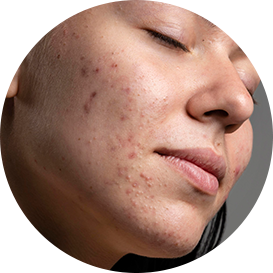 Glopetra Skin & Hair Care | Chemical-Free Products