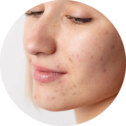 Glopetra Skin & Hair Care | Chemical-Free Products